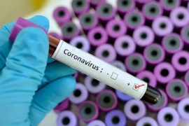 Francis Boyle: "Coronavirus creato in laboratorio, è un'arma da guerra biologica"